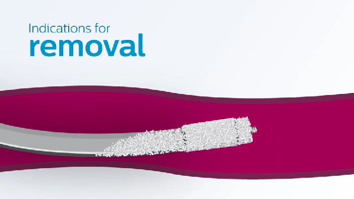 Tools for a difficult case