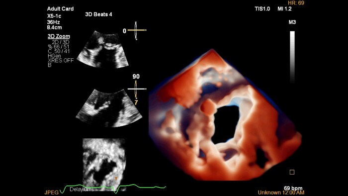 Снимок X5 1C Truevue