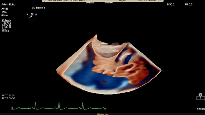 EPIQ CVx&nbsp;&mdash; TrueVue Glass
