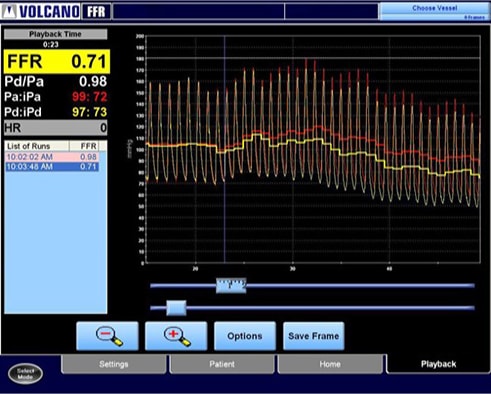 Изображение ФРК