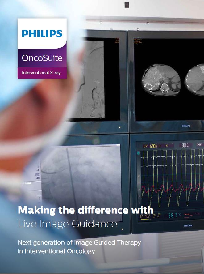 Брошюра об OncoSuite