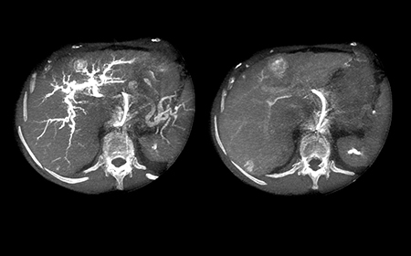 Функция двунаправленного вращения