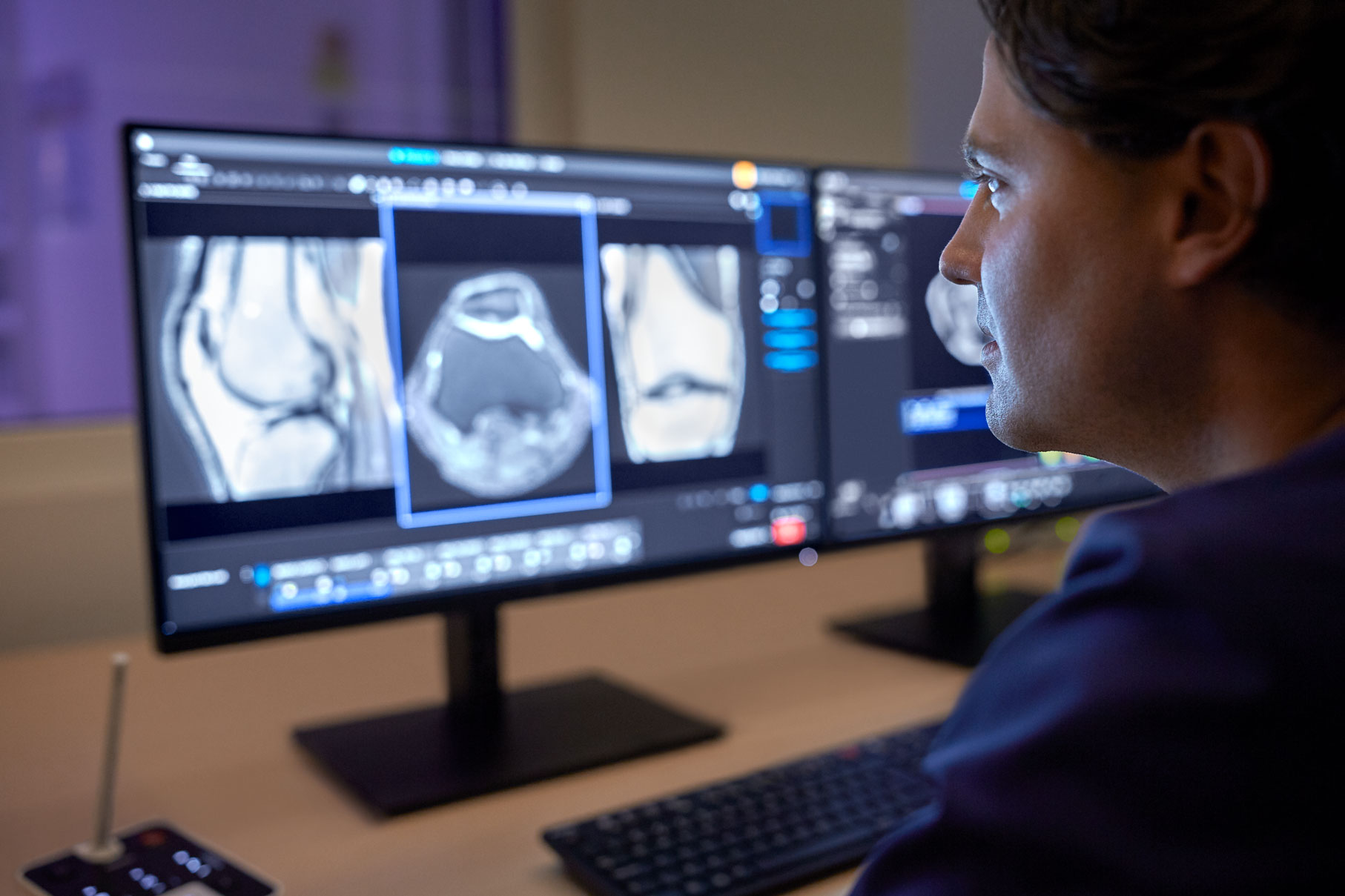 Низкое энергопотребление для магнитного резонанса с&nbsp;решением Philips PowerSave