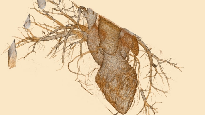 Фотография врачей, которые обсуждают результаты КТ, отображаемые на мониторе компьютера