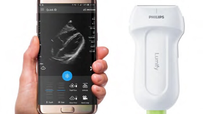 Телефон рядом с аппаратом Lumify