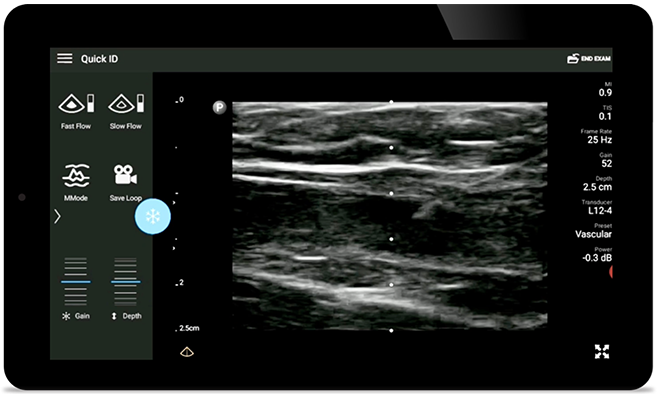 Уменьшение количества осложнений
