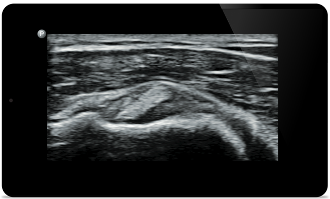 Начните лечение с точного диагноза