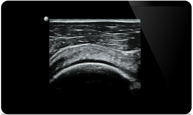 Быстрая диагностика благодаря визуализации всего организма