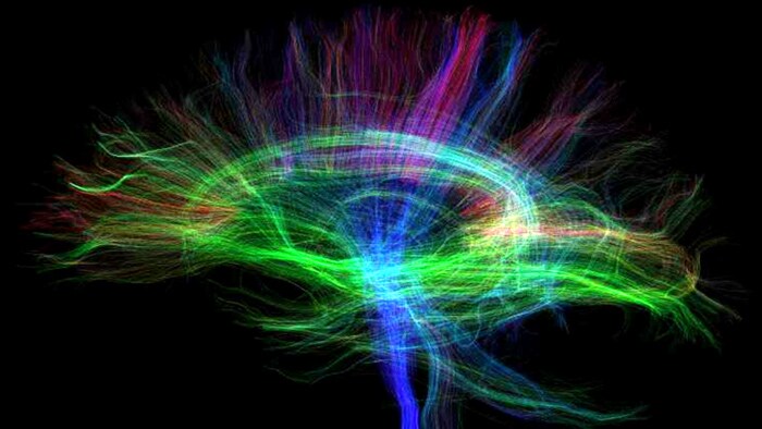 Микроструктурные нарушения в таламусе в остром периоде сотрясения головного мозга