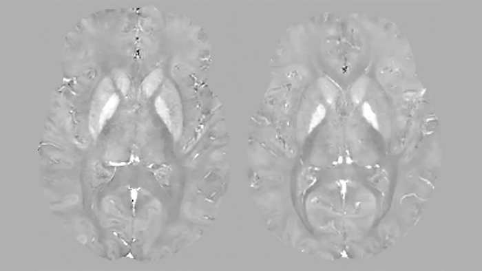 Возможности методики QSM