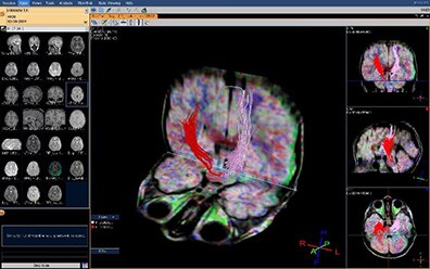 изображение мозга (download .jpg)