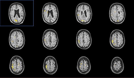 левое изображение (download .jpg)