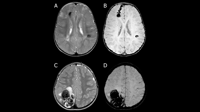 методике SWIp