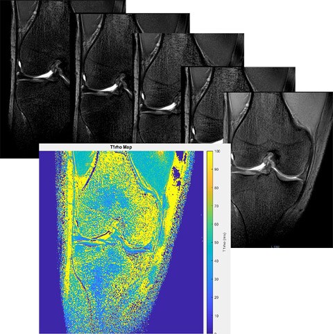 несколько изображений коленного сустава