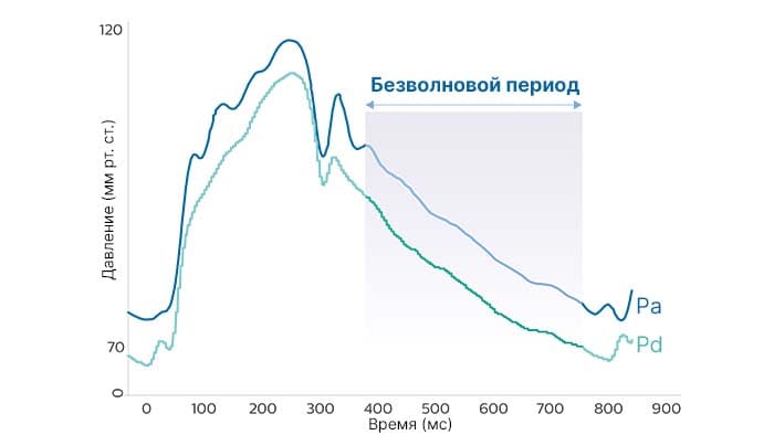 Дистальное коронарное давление